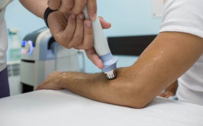 Does Shockwave Therapy Work for Elbow Tendonitis?
